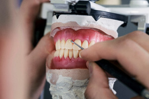 Technician working on dentures in dental lab