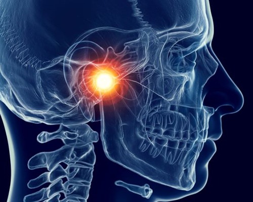 Illustration of human skull with TMJ highlighted in red